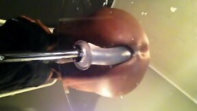 Butt monkey – colon collapse, no shame in the back