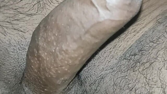 Penis peonies and phimosis: a comprehensive overview